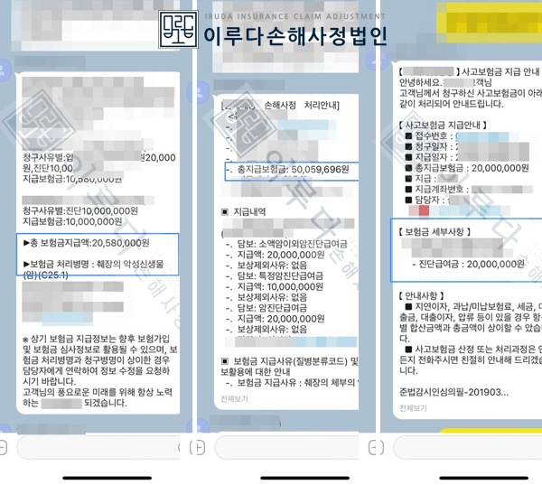 [C251] 췌장암 췌장신경내분비종양 손해사정사례 이루다손해사정법인 성공사례 썸네일