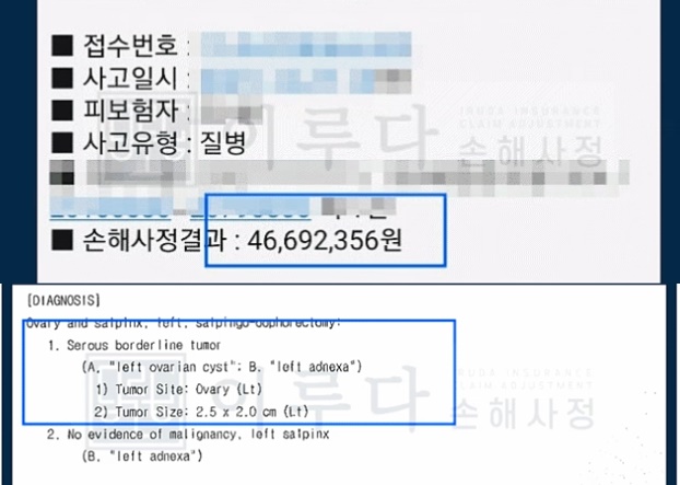 [D391,C56] 난소경계성종양 암보험금 손해사정사례 이루다 성공사례 썸네일