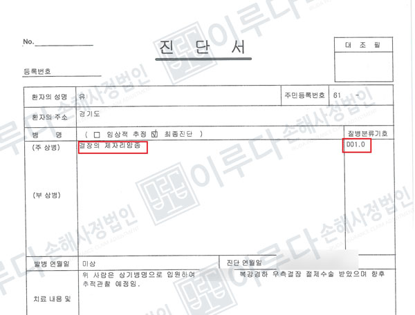 [D01] 결장의 제자리암종 손해사정사례 이루다손해사정법인 성공사례 썸네일